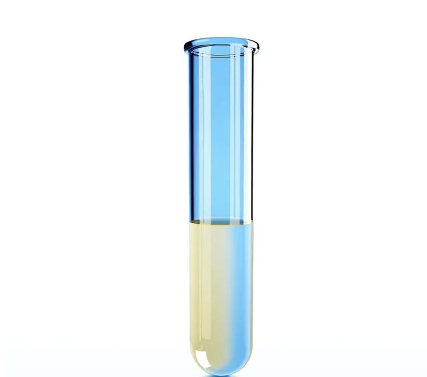 a blue scientific tube with human synovial fluid